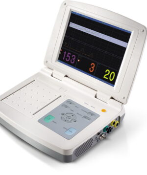 Monitor fetal